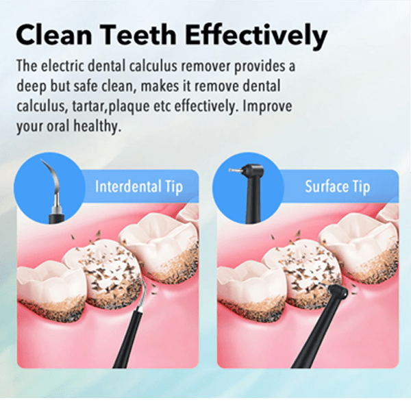 Dental Tartar Scr Tool - Crochet dentaire, Éliminateur de tartre à double  extrémité pour les dents, Détendant, Scr dentaire